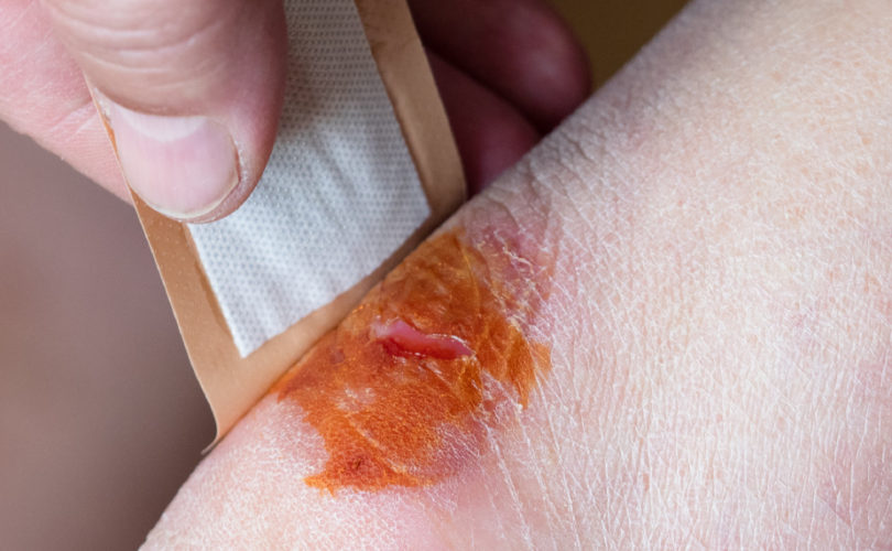 Iodine Wipes vs. Neosporin eFirstAidSupplies Blog