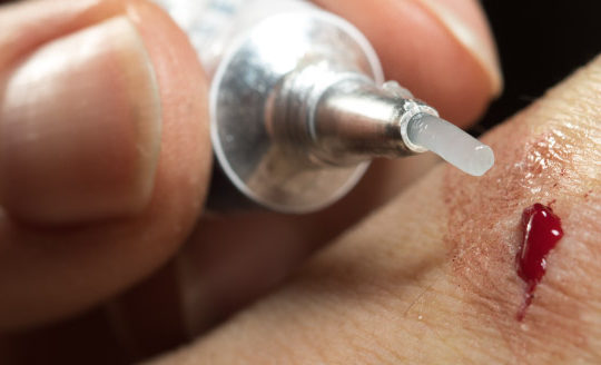 antibiotic ointment on a cut