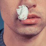First Aid for Nosebleeds
