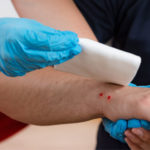 First Aid for Snakebites