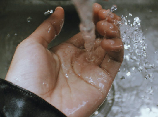 burned hand under cold water