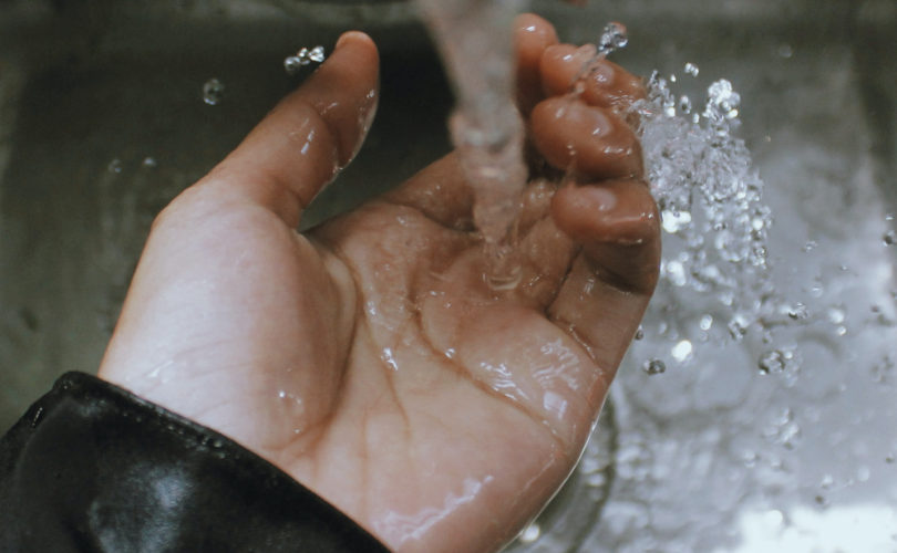 burned hand under cold water