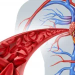 10 Warning Signs Of Poor Circulation You Shouldn’t Ignore