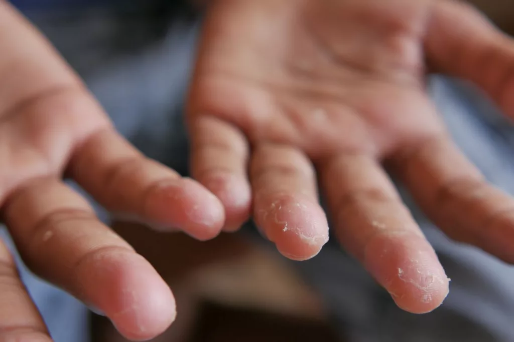 10 Warning Signs of Poor Circulation You Shouldn't Ignore