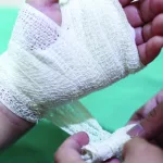 9 Types Of Wound Dressings