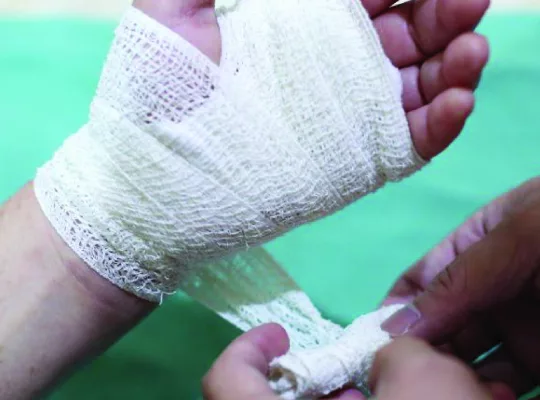 5 types of wound dressing-01