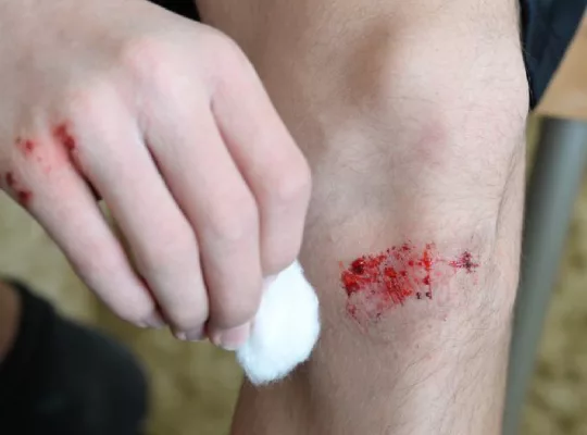Gauze stuck discount to wound