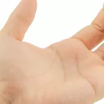 Lumps In Palm Of The Hand