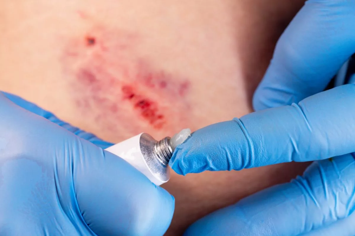 Steps For Caring For Wounds