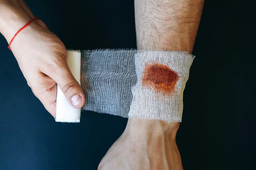 What Happens If Gauze Is Left In A Wound 