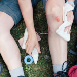 Is It Better to Cover a Wound or Let It Breathe?