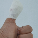 Everything You Need to Know About The Fingertip Amputation Healing Process