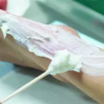 How Can You Tell If A Wound Is Infected Or Healing?