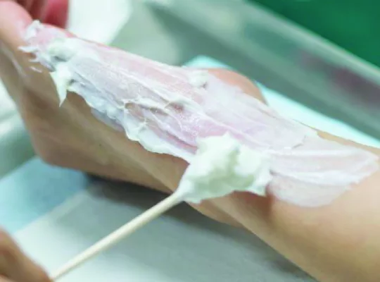 how to tell if a wound is infected-01