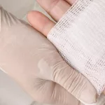 Post-Surgery Healing: The 6 Best Methods For A Speedy Recovery