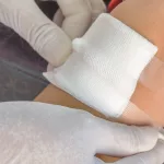 Surgical Wounds: 5 Signs Of Improper Healing