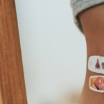 Tips on How to Treat a Scraped Knee