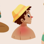 How Long Do Burn Blisters Last?